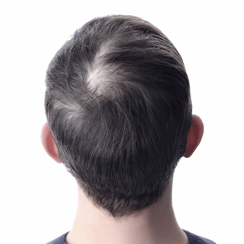 Orylo™ RootBoost Šampon za obnovu kose