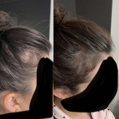 Bello Hair Growth Shampoo