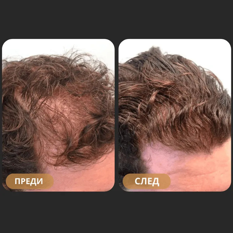 Orylo™ RootBoost Възстановяващ Шампоан за Коса -v2 (BG)