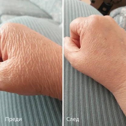 Novaderm™ | Крем за Възстановяване на Кожата (BG)