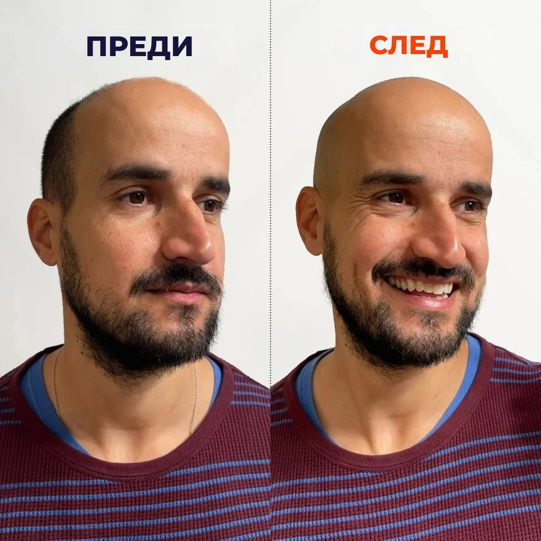 ORYLO | OryloEdge™ (BG)