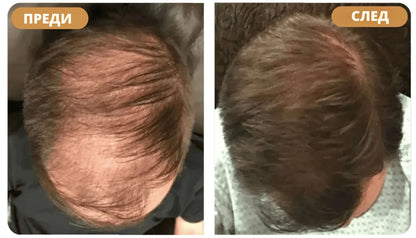 Orylo™ RootBoost Възстановяващ Шампоан за Коса -v2 (BG)