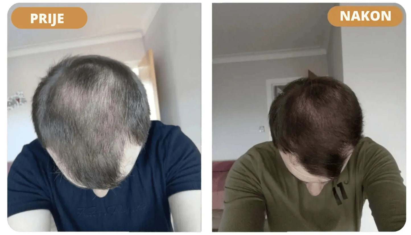 Orylo™ RootBoost Šampon za obnovu kose