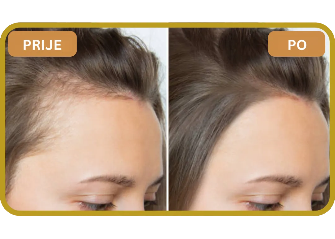 Orylo™ RootBoost Šampon za obnovu kose