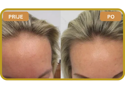 Orylo™ RootBoost Šampon za obnovu kose