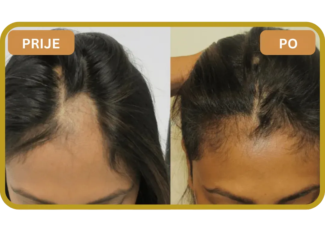 Orylo™ RootBoost Šampon za obnovu kose