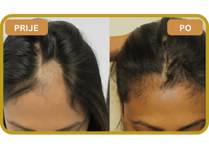 Orylo™ RootBoost Šampon za obnovu kose