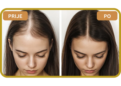 Orylo™ RootBoost Šampon za obnovu kose