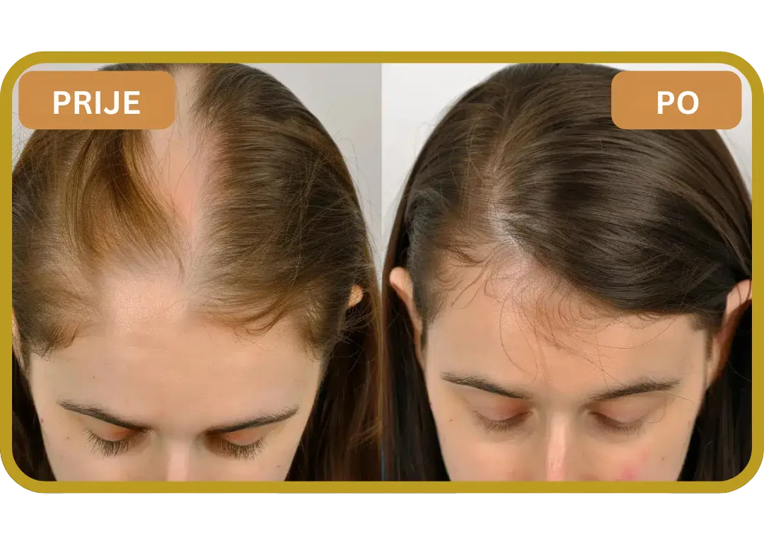 Orylo™ RootBoost Šampon za obnovu kose