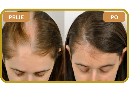 Orylo™ RootBoost Šampon za obnovu kose