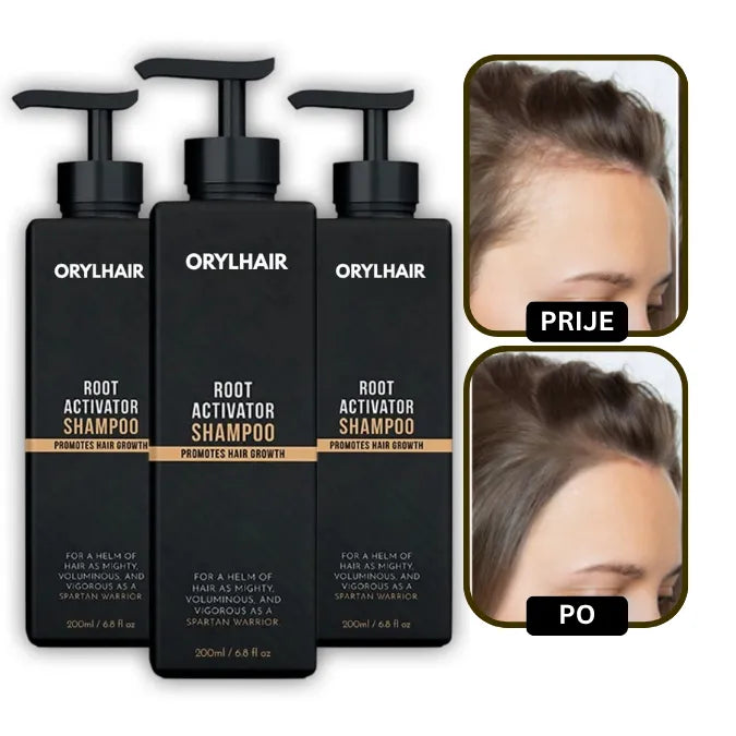 Orylo™ RootBoost Šampon za obnovu kose