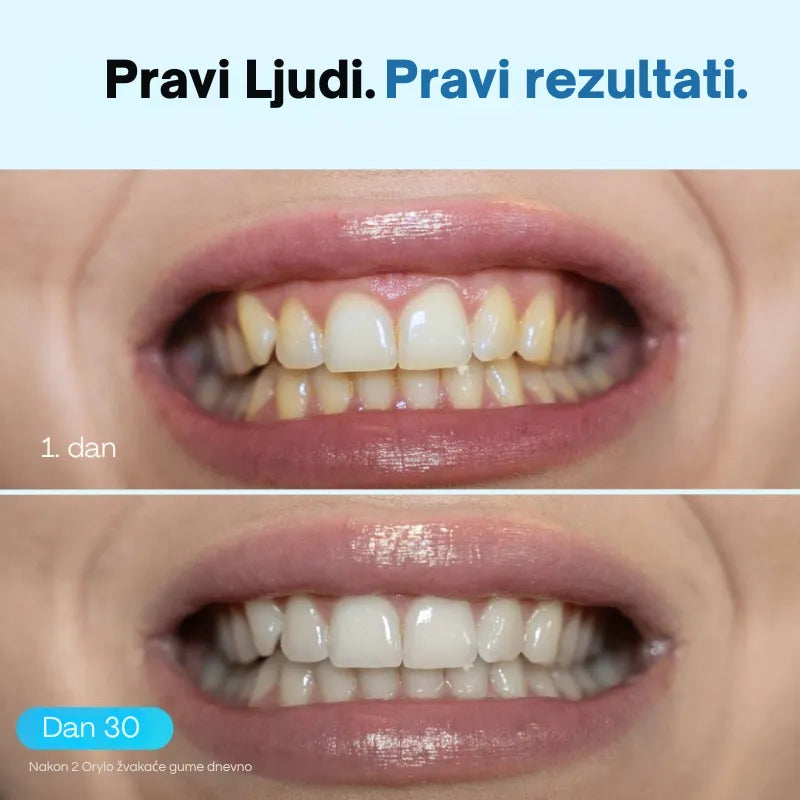 Žvakaća guma za izbjeljivanje zubi