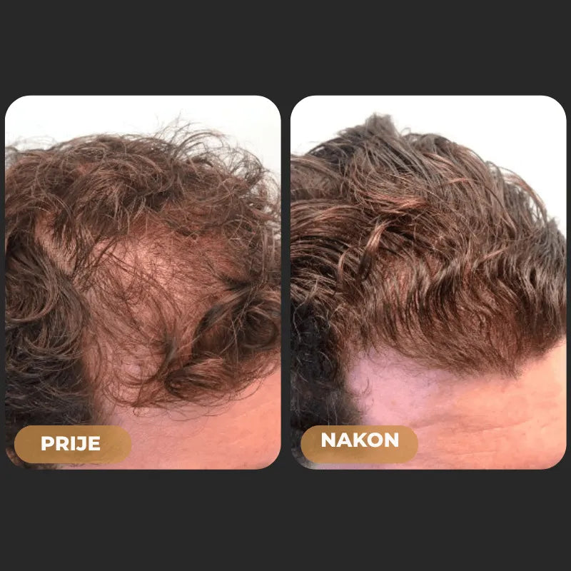 Orylo™ RootBoost Šampon za obnovu kose