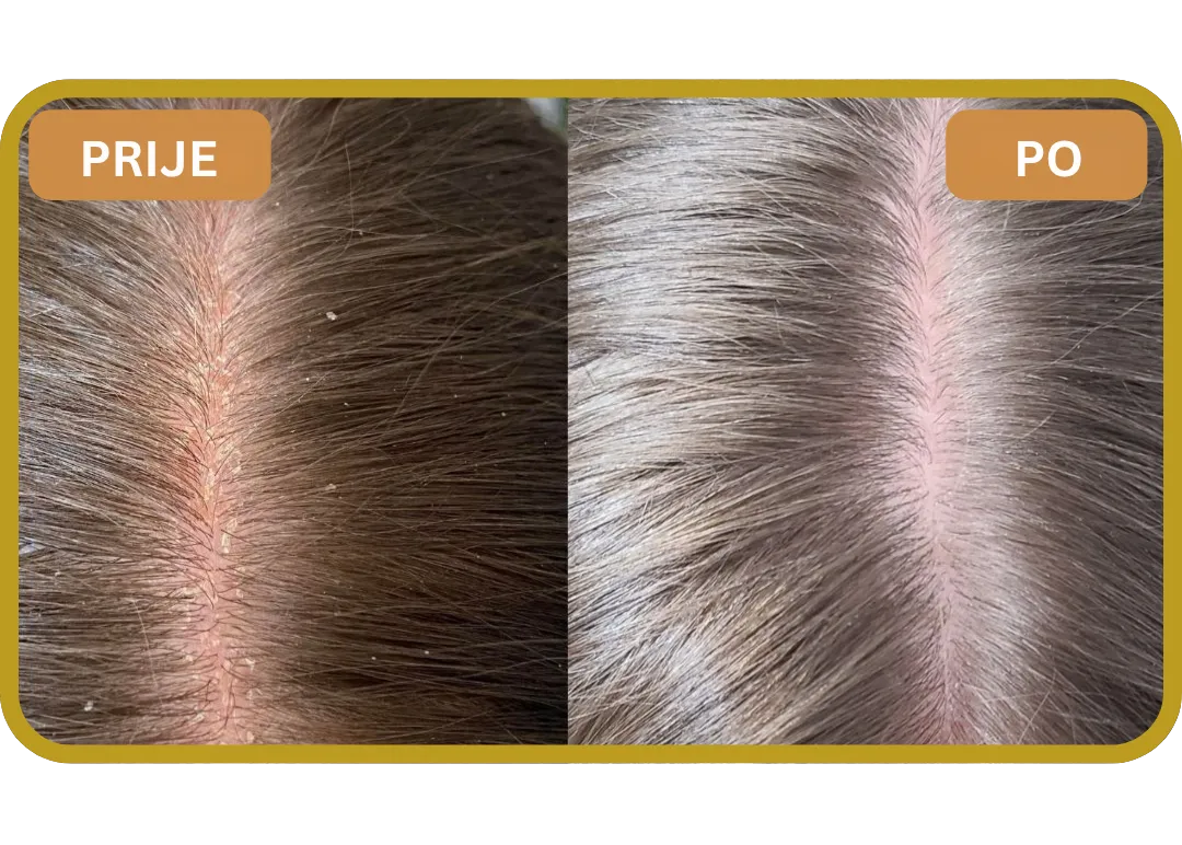 Orylo™ RootBoost Šampon za obnovu kose