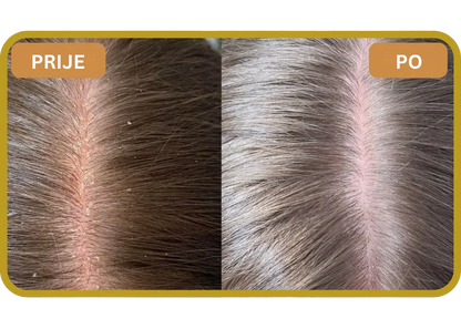 Orylo™ RootBoost Šampon za obnovu kose