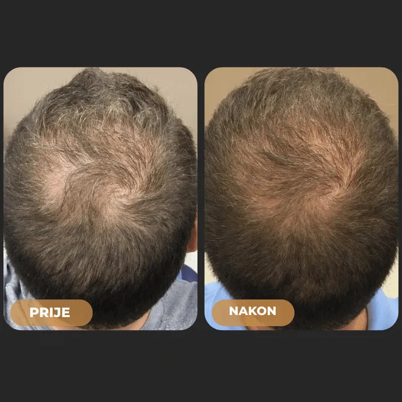Orylo™ RootBoost Šampon za obnovu kose