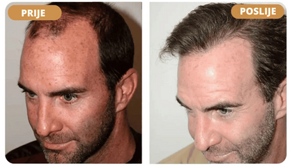 Orylo™ RootBoost Šampon za obnovu kose