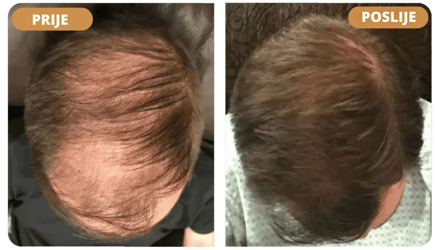 Orylo™ RootBoost Šampon za obnovu kose