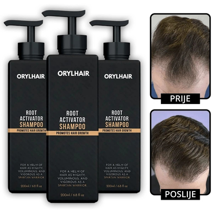 Orylo™ RootBoost Šampon za obnovu kose