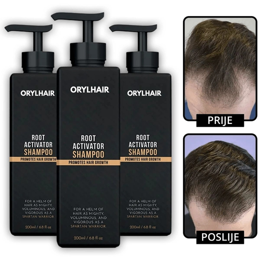Orylo™ RootBoost Šampon za obnovu kose