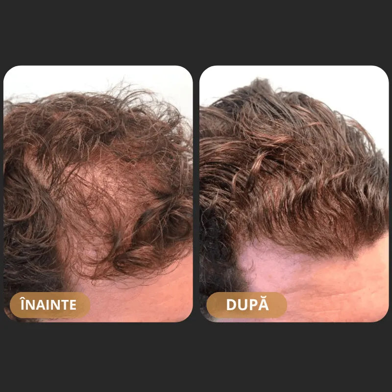 Orylo™ RootBoost Șampon pentru revitalizarea părului -V2 (RO)