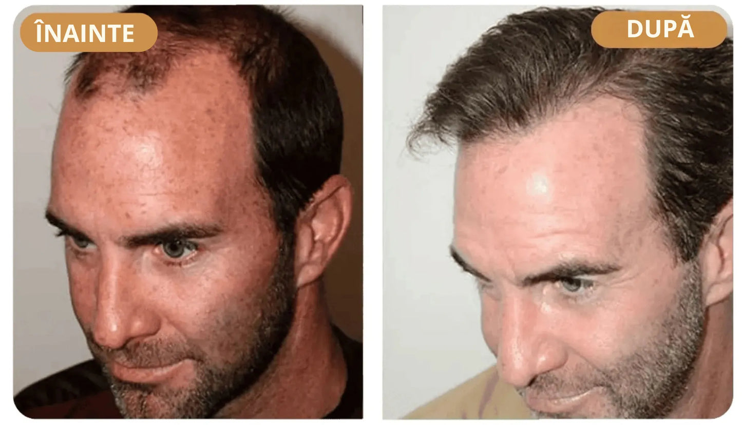 Orylo™ RootBoost Șampon pentru revitalizarea părului -V2 (RO)