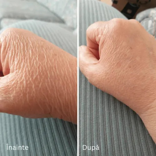 Novaderm™ | Cremă Reparatoare pentru Piele (RO)