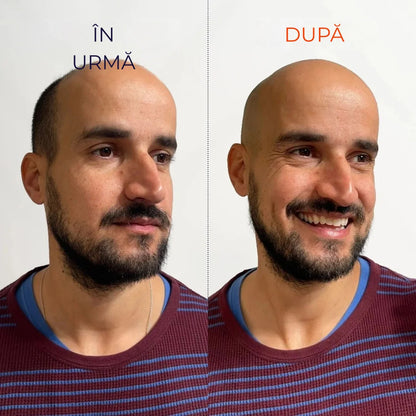 ORYLO | OryloEdge™  (ROMA)