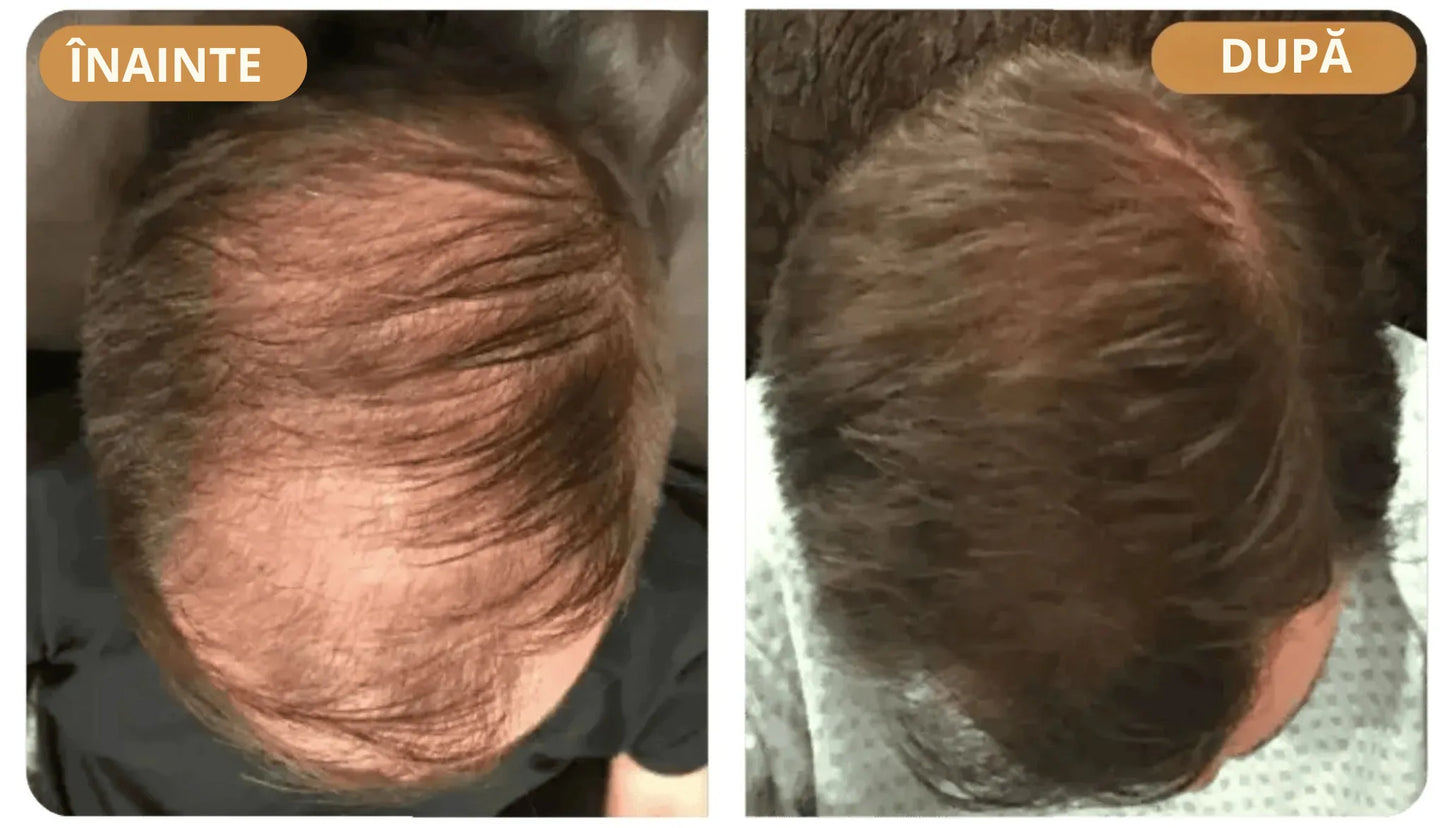 Orylo™ RootBoost Șampon pentru revitalizarea părului -V2 (RO)