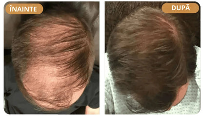 Orylo™ RootBoost Șampon pentru revitalizarea părului -V2 (RO)