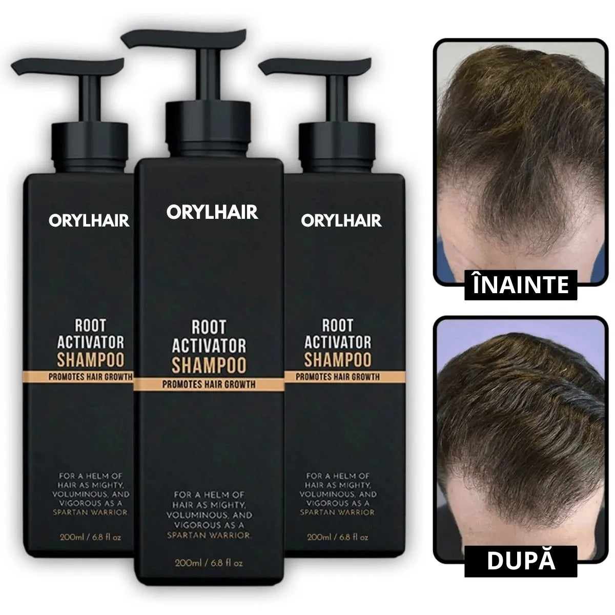 Orylo™ RootBoost Șampon pentru revitalizarea părului -V2 (RO)