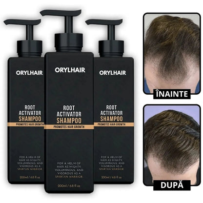 Orylo™ RootBoost Șampon pentru revitalizarea părului -V2 (RO)
