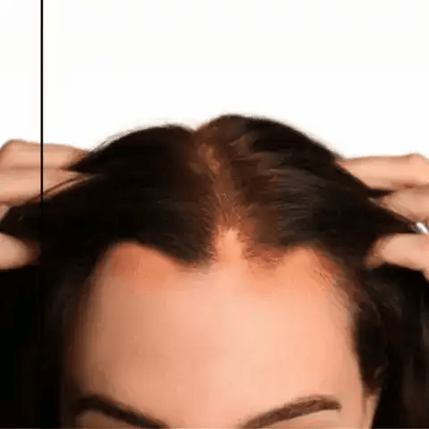 Orylo™ RootBoost Šampon za obnovu kose